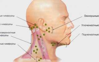 Симптомы, диагностика и лечение опухоли на шее справа, слева или сзади