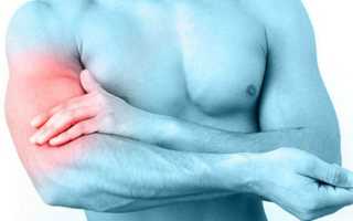 Растяжение мышц руки: причины, симптомы, первая помощь и лечение народными средствами