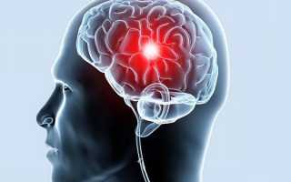 Болезни головного мозга у человека — симптомы и признаки, диагностика, методы лечения и профилактика