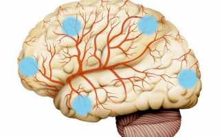 Инфекционные поражения головного мозга – общая информация о нейроинфекциях, их течении и терапевтическом подходе